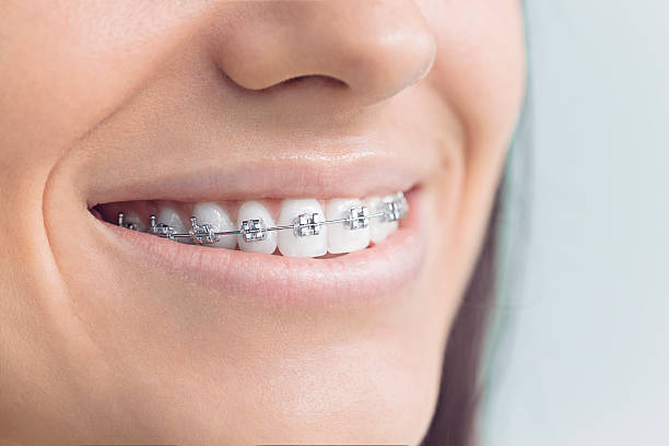 Full Mouth Reconstruction in Maitland, FL